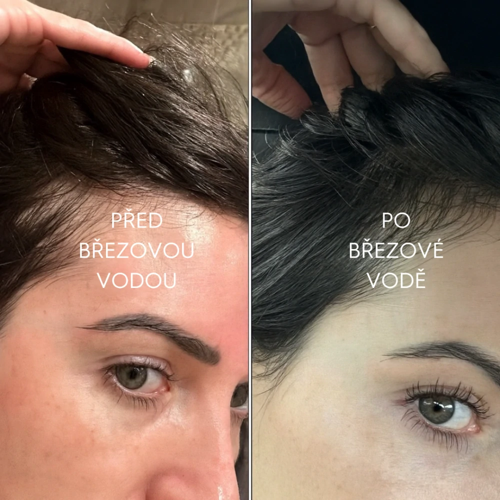 Březový oplach pro zdravé a lesklé vlasy 200ml