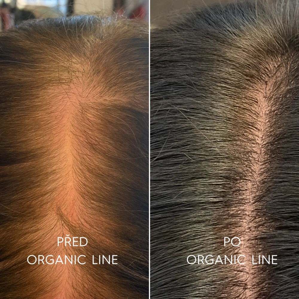 Šampon pro mastné vlasy ORGANIC LINE 250ml